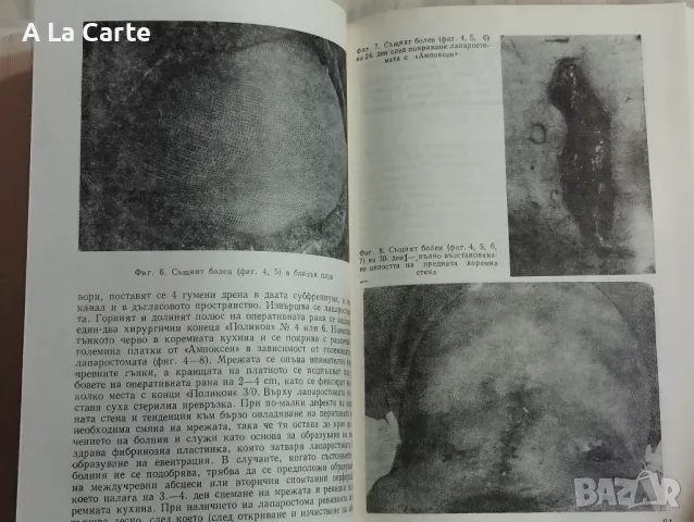Релапаротомии, снимка 5 - Специализирана литература - 47944365