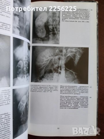 Ангиографски атлас на бъбречните заболявания, снимка 3 - Специализирана литература - 50695034