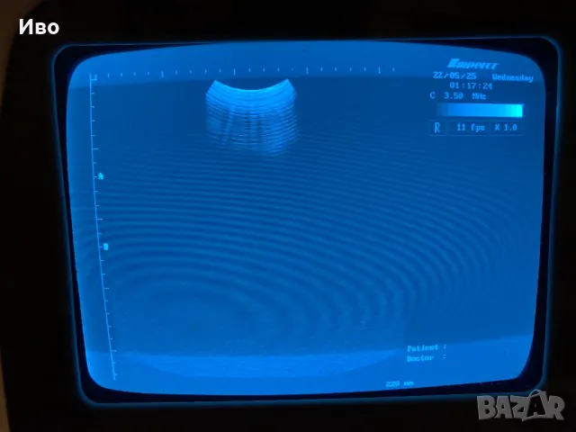 Ехограф ултразвуков скенер Emperor EMP 880, снимка 9 - Медицинска апаратура - 50367810
