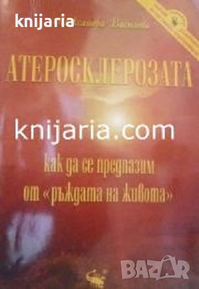 Атеросклерозата: Как да се предпазим от ръждата на живота