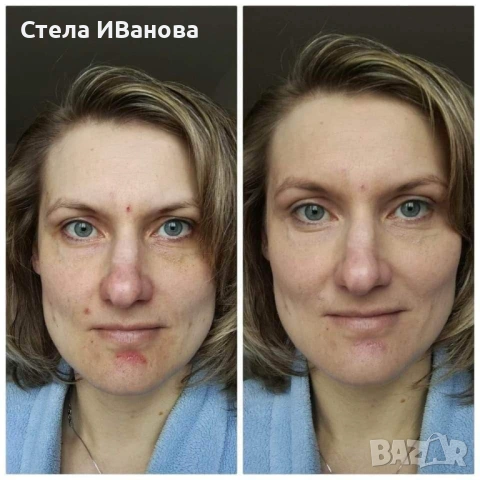 Крем за скриване на несъвършенства, петна и акне - маскира, хидратира. По-добър от фон дьо тен, снимка 2 - Козметика за лице - 53393168