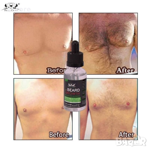 Органично масло против косопад и растеж на брадата - TV1133, снимка 6 - Други - 52595072