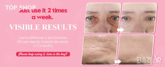 Професионален радиочестотен уред за стягане на кожата - Uaike RF 01, снимка 12 - Козметични уреди - 48804994