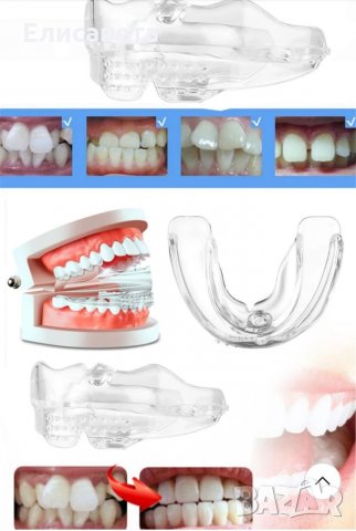 Промо -Невидими брекети-шини за зъби ,алайнери, снимка 11 - Козметика за лице - 31933178