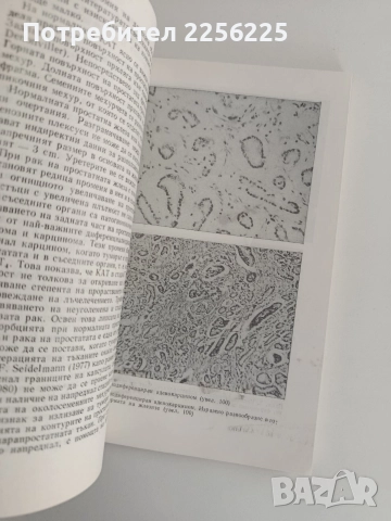 Рак на простатата, снимка 5 - Специализирана литература - 52913652