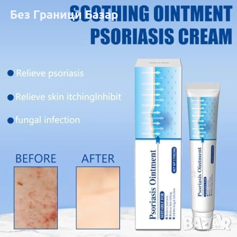 Нов Натурален крем при псориазис – без аромат, нежен към чувствителна кожа, снимка 3 - Други - 53368793
