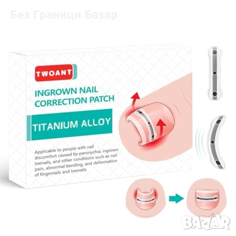 Нов Комплект за корекция на врастнали нокти 9 броя 3 размера лечение