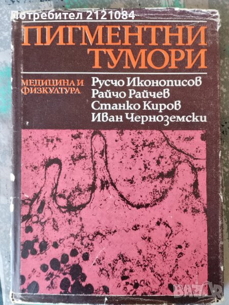Пигментни тумори / Иконописов, Райчев, Киров,Черноземски , снимка 1