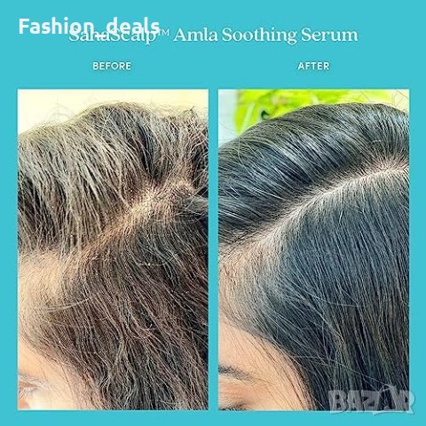 Нов Fable & Mane Успокояващ серум за скалп Лечебно действие Подарък Мъже Жени, снимка 2 - Други - 42969852