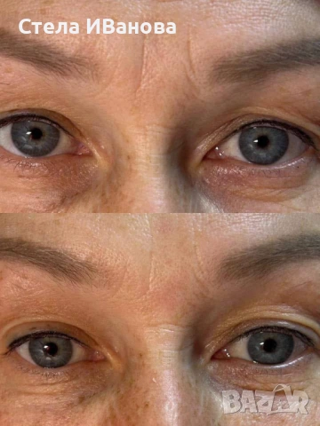 Комплект за лице против бръчки и стареене с ефект подобен на БОТОКС, ИДЕЯ ЗА ПОДАРЪК