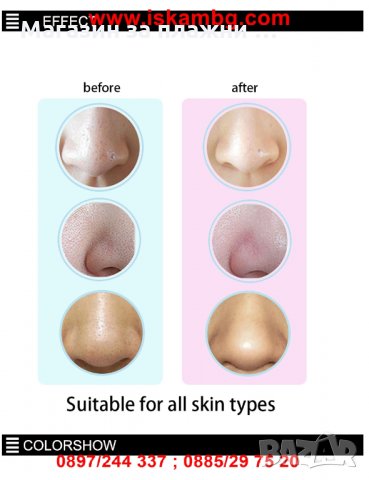 Вакуум уред за акне и черни точки - код 1896, снимка 6 - Козметика за лице - 26970525