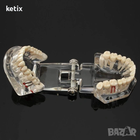 Дентален модел с реставрация, снимка 6 - Стоматология - 53018772