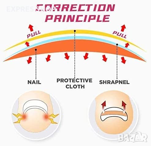 ЛЕПЕНКИ ЗА ВРАСТНАЛ НОКЪТ INGROWN TOENAIL КОМПЛЕКТ ОТ 50 БРОЯ, снимка 3 - Други - 37585228