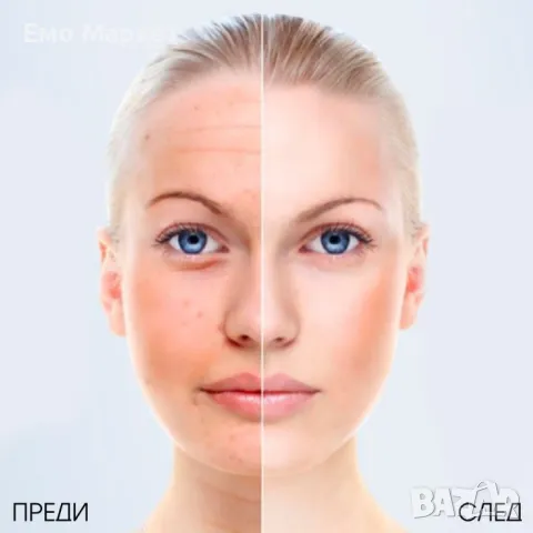 Ултразвуков масажор за лице - TV224, снимка 4 - Масажори - 49148231