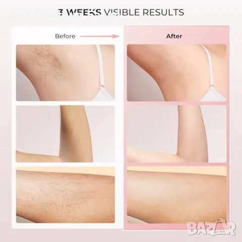 Нов IPL уред за епилация с 5°C охлаждане и 999,900 импулса премахва косми, снимка 9 - Други - 48602626