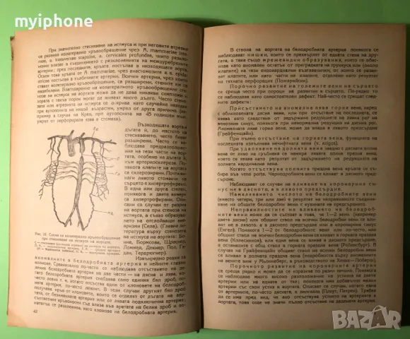 Стара Книга Частна Патологична Анатомия Сърце и Кръвоносни Съдове, снимка 5 - Специализирана литература - 49204157