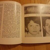 Атлас по Ортодонтия - 1988 год., доц. Декова , 130 страници, снимка 2 - Специализирана литература - 42783069