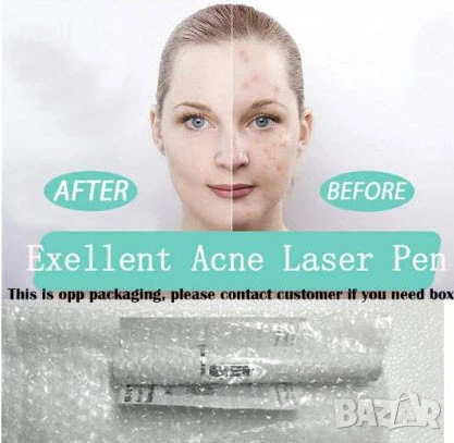 Лазер срещу - против гъбички по ноктите и акне комплект  , снимка 6 - Други - 50530090