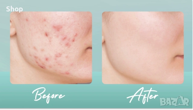 🧖🏻‍♀️ Третиноин крем, Gold Standart 🪞, снимка 5 - Козметика за лице - 53225556