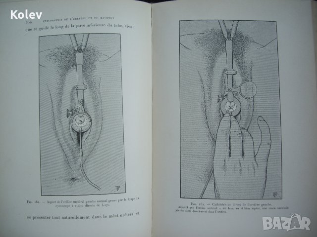 Медицинска книга Изследване на уринарната система, 1909 , френска, снимка 15 - Специализирана литература - 33406019