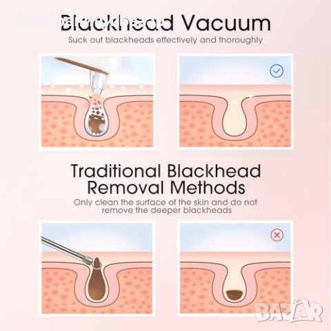 Нов Мощен Вакуумен Уред Почистващ Черни Точки лице кожа 4 Глави, снимка 4 - Други - 43568687