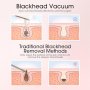 Нов Мощен Вакуумен Уред Почистващ Черни Точки лице кожа 4 Глави, снимка 4