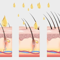 Апликатор скалп растеж подмладяване коса кожа масаж етерично масло / състояние: ново, снимка 6 - Козметика за тяло - 44912059