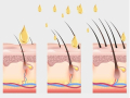 Апликатор скалп растеж подмладяване коса кожа масаж етерично масло / състояние: ново, снимка 6