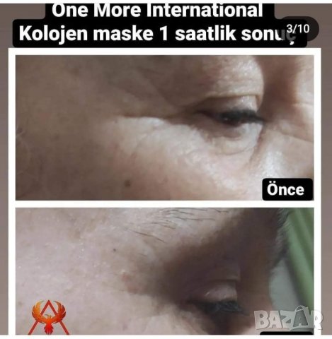 Sornie колагенови anti-aging маски, One , снимка 10 - Козметика за лице - 39687260