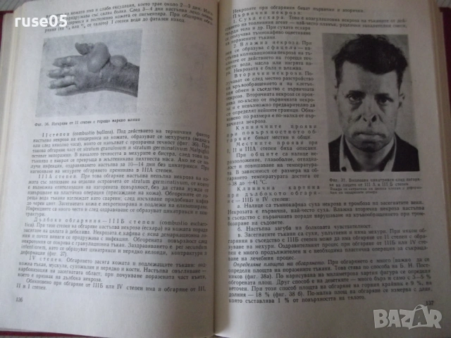 Книга "Пропедевтика на хирургичните болести-К.Енев"-376 стр., снимка 5 - Специализирана литература - 53222293