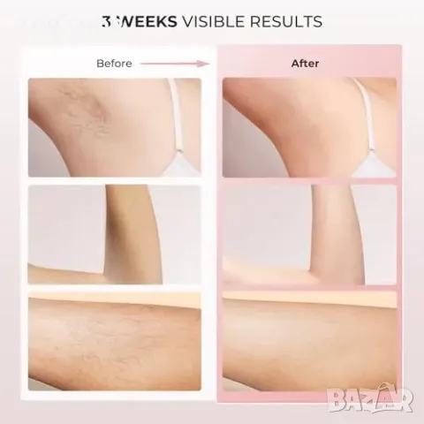 Нов IPL уред за епилация с 5°C охлаждане и 999,900 импулса премахва косми, снимка 9 - Тримери - 49339237