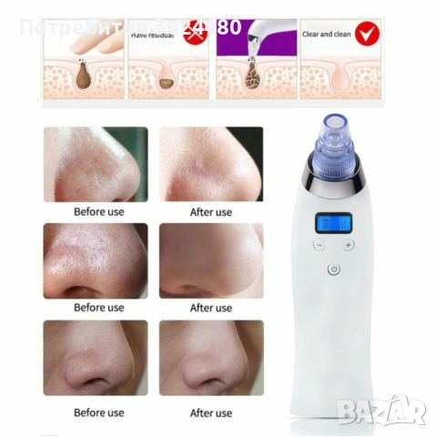 Уред за почистване на лице с акне 1969, снимка 2 - Други - 53455997