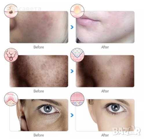 LED маска за лице , снимка 10 - Козметика за лице - 40397813