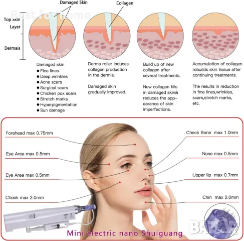 Професионален дерма пен за иглотерапия BOWKA, снимка 11 - Медицинска апаратура - 48272294
