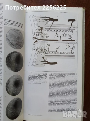 Флуоресцеинова ангиография на очното дъно, снимка 4 - Специализирана литература - 50670446