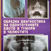 Образна диагностика на одонтогенните кисти и тумори в челюстите,Доан Зия,Софи-Р,2005г.244стр., снимка 1 - Енциклопедии, справочници - 33406870