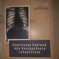 Рентгенови картини при белодробната туберкулоза-1957г, снимка 1 - Специализирана литература - 34650257