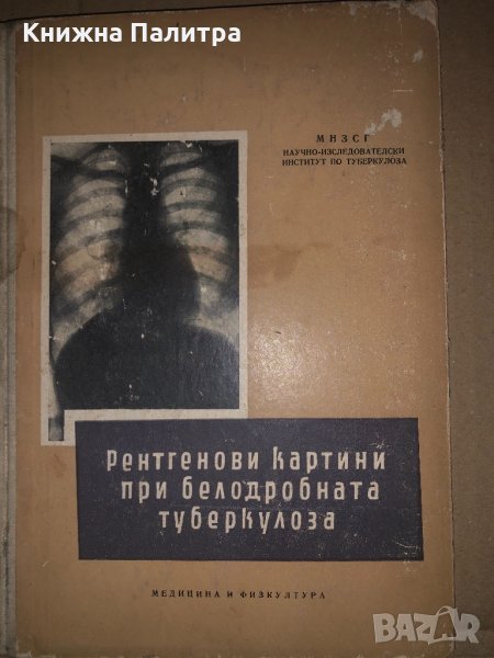 Рентгенови картини при белодробната туберкулоза-1957г, снимка 1