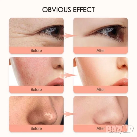 БЕЗЖИЧНА LED маска за лице за светлинна терапия, Маска анти ейдж, акне, снимка 10 - Козметични уреди - 52196097