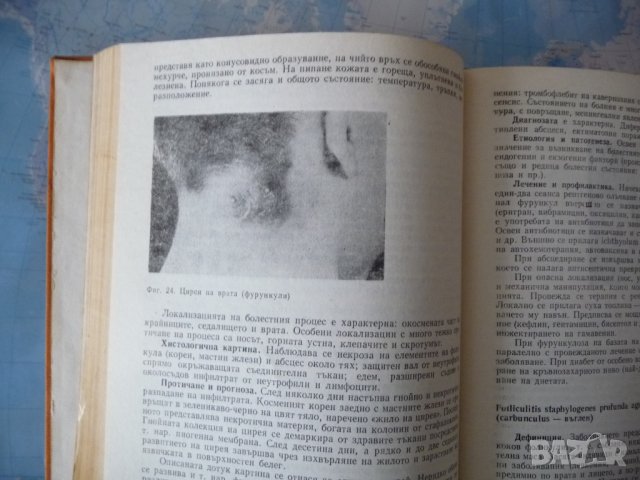 Дерматология и венерология кожа дерматит сифилис гонококция, снимка 2 - Специализирана литература - 40730435