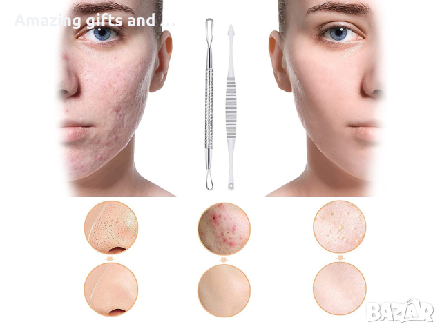 Козметичен комплект за премахване на черни точки, снимка 9 - Други - 44842650