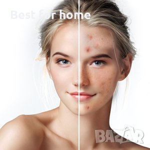 Уред за премахване на черни точки, акне и абразио Frohmen Prof, снимка 3 - Други - 36746379