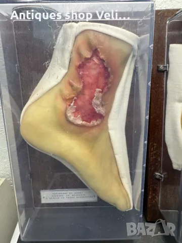 УНИКАЛНО Восъчни Ръчно Изработени Анатомични Мулажи КОЛЕКЦИЯ №69340 , снимка 9 - Антикварни и старинни предмети - 50402170