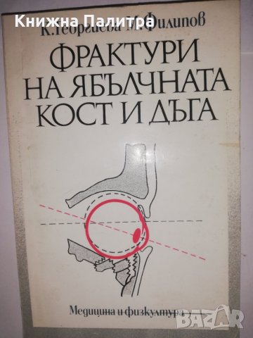 Фрактури на ябълчната кост и дъга 