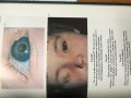 Глазные болезни - aтлас, снимка 6