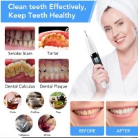 Професионален ултразвуков уред за почистване на зъби и зъбен камък, снимка 2 - Стоматология - 43379397
