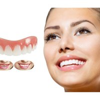 Изкуствени зъби Оверлей( прикриване на развалени зъби), снимка 2 - Други - 43989346