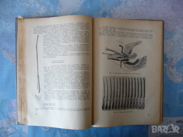 Гинекология Илия Щъркалев гинекологичен преглед женски полови органи, снимка 2 - Специализирана литература - 40729925