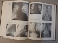 Рентгенодиагнистический атлас. Том 2: Болезни внутренних органов, снимка 7
