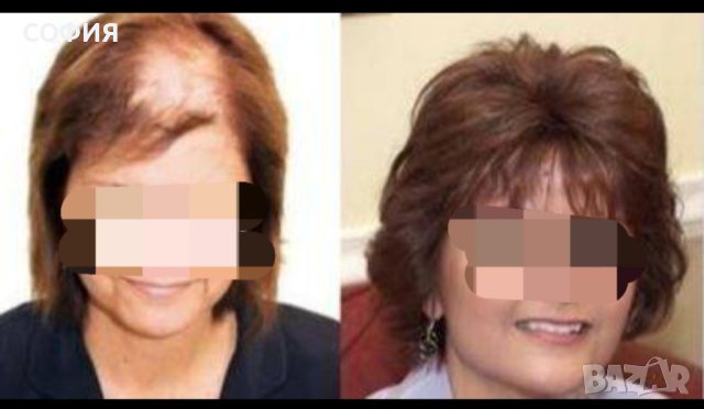 Тупета и перуки, снимка 7 - Аксесоари за коса - 40446175